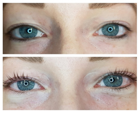 voor en na Lash Volume Lift behandeling